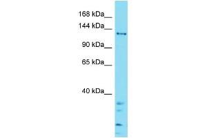 anti-Zinc Finger, SWIM-Type Containing 5 (ZSWIM5) (C-Term) antibody