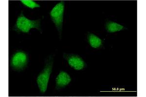 Immunofluorescence of monoclonal antibody to PFDN2 on HeLa cell.