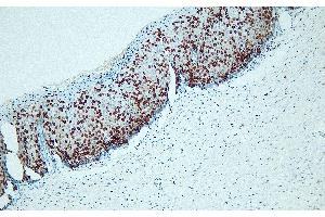 Immunohistochemistry (IHC) image for anti-Antigen Identified By Monoclonal Antibody Ki-67 (MKI67) antibody (ABIN7598906) (Ki-67 antibody)