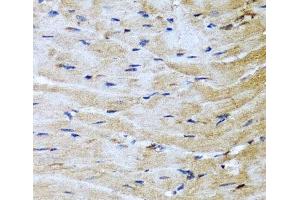 Immunohistochemistry of paraffin-embedded Mouse heart using M6PR Polyclonal Antibody at dilution of 1:100 (40x lens). (M6PR antibody)