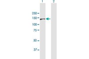 Western Blot analysis of AP3B1 expression in transfected 293T cell line by AP3B1 MaxPab polyclonal antibody. (AP3B1 antibody  (AA 1-1094))
