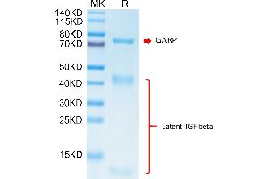 Biotinylated Cynomolgus GARP&Latent TGF beta Complex on Tris-Bis PAGE under reduced condition.