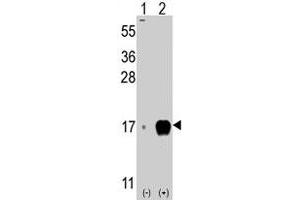 Western blot analysis of IFITM3 (arrow) using rabbit IFITM3 polyclonal antibody .