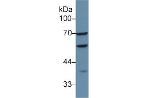 Detection of CAP1 in Human HepG2 cell lysate using Polyclonal Antibody to Adenylyl Cyclase Associated Protein 1 (CAP1) (CAP1 antibody  (AA 38-149))