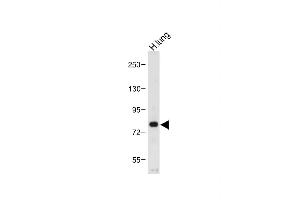 Anti-MUC20 Antibody (C-term) at 1:1000 dilution + Human lung tissue lysate Lysates/proteins at 20 μg per lane.