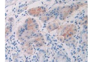 Detection of Slit1 in Human Stomach Tissue using Polyclonal Antibody to Slit Homolog 1 (Slit1) (SLIT1 antibody  (AA 647-835))