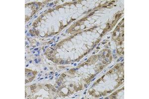 Immunohistochemistry of paraffin-embedded human stomach using MAPK1 antibody. (ERK2 antibody  (AA 200-300))