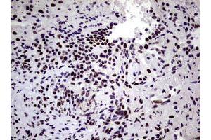 Image no. 2 for anti-Nibrin (NBN) (AA 183-460) antibody (ABIN1491066) (Nibrin antibody  (AA 183-460))