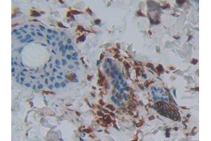 DAB staining on IHC-P; Samples: Rat Skin Tissue (PLA2G2A antibody  (AA 22-146))
