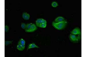 Immunofluorescence (IF) image for anti-phosphoglycerate Dehydrogenase (PHGDH) (AA 2-251) antibody (ABIN7149438)