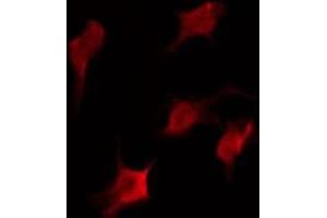 ABIN6275979 staining COLO205 by IF/ICC. (CasLTR2 antibody  (Internal Region))