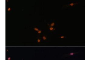 Immunofluorescence analysis of C6 cells using SMAD7 Polyclonal Antibody at dilution of 1:100. (SMAD7 antibody)