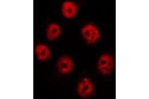ABIN6267621 staining A431 by IF/ICC. (PTPN11 antibody  (pTyr542))