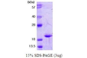 SDS-PAGE (SDS) image for Superoxide Dismutase 1, Soluble (SOD1) (AA 1-154) protein (ABIN667079) (SOD1 Protein (AA 1-154))