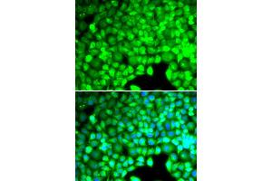 Immunofluorescence analysis of U2OS cells using CYTH2 antibody (ABIN5974231). (Cytohesin 2 antibody)
