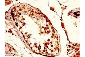 IHC image of ABIN7171526 diluted at 1:200 and staining in paraffin-embedded human testis tissue performed on a Leica BondTM system. (TPX2 antibody  (AA 160-320))