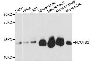 Western blot analysis of extracts of various cell lines, using NDUFB2 antibody. (NDUFB2 antibody  (AA 34-105))