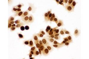 Immunohistochemistry (IHC) image for anti-Minichromosome Maintenance Complex Component 7 (MCM7) (AA 699-719), (C-Term) antibody (ABIN3044178)