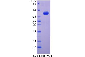 Image no. 1 for Nuclear Factor kappa B2 (AA 37-342) protein (His tag) (ABIN4988897)