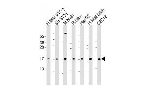 All lanes : Anti-Autophagy GABAR Antibody (N-term) at 1:1000-1 :2000 dilution Lane 1: human fetal kidney lysate Lane 2: SH-SY5Y whole cell lysate Lane 3: mouse brain lysate Lane 4: rat brain whole cell lysate Lane 5: HepG2 whole cell lysate Lane 6: human fetal brain lysate Lane 7: C2C12 whole cell lysate Lysates/proteins at 20 μg per lane. (GABARAP antibody  (AA 1-30))