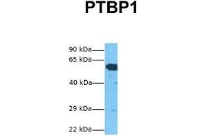 Host:  Rabbit  Target Name:  PTBP1  Sample Tissue:  Human HepG2  Antibody Dilution:  1. (PTBP1 antibody  (N-Term))