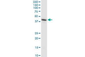 HS6ST1 monoclonal antibody (M05A), clone 1H4. (HS6ST1 antibody  (AA 303-401))