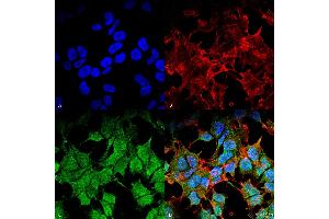Immunocytochemistry/Immunofluorescence analysis using Mouse Anti-Kir6. (KCNJ8 antibody  (AA 306-424) (PE))