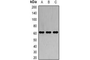 Western blot analysis of IRSp53 expression in A549 (A), K562 (B), SW620 (C) whole cell lysates.