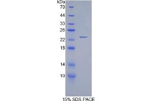 SDS-PAGE of Protein Standard from the Kit  (Highly purified E. (GREM1 ELISA Kit)