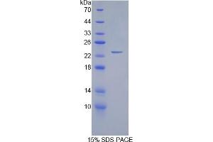 SDS-PAGE (SDS) image for Gremlin 1 (GREM1) ELISA Kit (ABIN6730963)