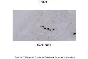 Sample Type : Frog brain Primary Antibody Dilution : 1:500 Secondary Antibody : Biotinylated goat anti-rabbit Secondary Antibody Dilution : 1:200 Color/Signal Descriptions : Black: EGR1 Gene Name : Egr1 a Submitted by : Eva Fischer, Colorado State University (EGR1 antibody  (C-Term))