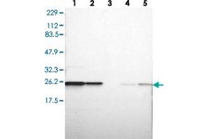 Western blot analysis of Lane 1: RT-4, Lane 2: U-251 MG, Lane 3: Human Plasma, Lane 4: Liver, Lane 5: Tonsil with RAB5C polyclonal antibody  at 1:250-1:500 dilution. (Rab5c antibody)