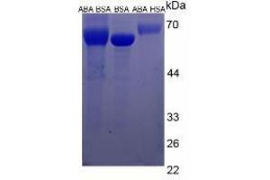 Image no. 2 for Abscisic Acid (ABA) protein (HSA) (ABIN1880173) (Abscisic Acid Protein (ABA) (HSA))