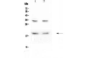 Western blot analysis of Pleiotrophin using anti-Pleiotrophin antibody . (Pleiotrophin antibody  (AA 33-168))