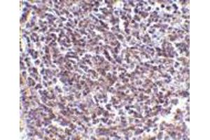 Immunohistochemistry of Aven in human spleen tissue with Aven antibody at 5 μg/ml. (AVEN antibody  (N-Term))