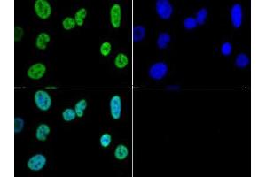 Immunofluorescence of Rabbit Anti-Histone H3 K4/me3 Antibody. (Histone 3 antibody  (H3K4me3))