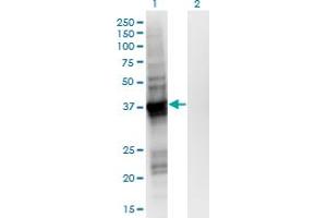 Western Blot analysis of GIPC2 expression in transfected 293T cell line by GIPC2 monoclonal antibody (M02), clone 4H8.