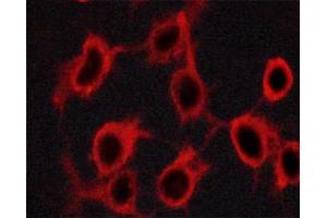 ABIN6267324 staining Hela cells by ICC/IF.