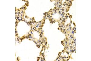 Immunohistochemistry (IHC) image for anti-DNA-Damage-Inducible Transcript 3 (DDIT3) (C-Term) antibody (ABIN3020710) (DDIT3 antibody  (C-Term))