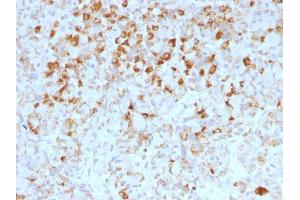 Formalin-fixed, paraffin-embedded human Pituitary stained with LH-beta Mouse Monoclonal Antibody (LHb/1214). (LHB antibody)