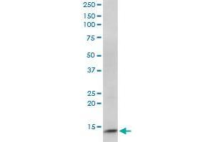 CIDEC monoclonal antibody (M07), clone 2E2. (CIDEC antibody  (AA 53-141))