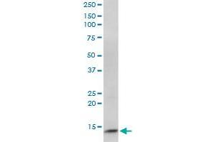 CIDEC monoclonal antibody (M07), clone 2E2. (CIDEC antibody  (AA 53-141))