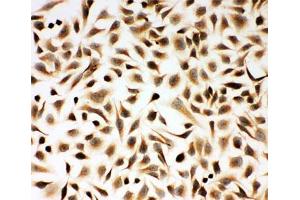 Immunocytochemistry (ICC) image for anti-SMAD, Mothers Against DPP Homolog 2 (SMAD2) (N-Term) antibody (ABIN3032617)