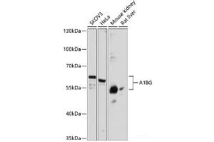 Western blot analysis of extracts of various cell lines using A1BG Polyclonal Antibody at dilution of 1:3000. (A1BG antibody)