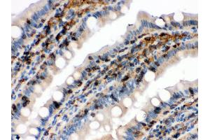 Anti- Cofilin Picoband antibody, IHC(P) IHC(P): Rat Intestine Tissue (Cofilin antibody  (C-Term))