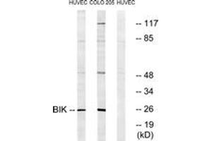 Western Blotting (WB) image for anti-BCL2-Interacting Killer (Apoptosis-Inducing) (BIK) (AA 18-67) antibody (ABIN2888586) (BIK antibody  (AA 18-67))