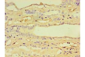 Immunohistochemistry of paraffin-embedded human kidney tissue using ABIN7157760 at dilution of 1:100 (CCBL1 antibody  (AA 1-372))