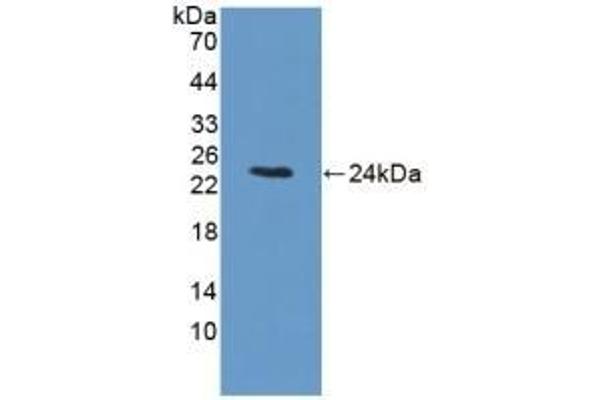 BCKDK 抗体  (AA 44-223)