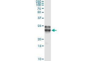 Immunoprecipitation of FGF21 transfected lysate using anti-FGF21 monoclonal antibody and Protein A Magnetic Bead , and immunoblotted with FGF21 MaxPab rabbit polyclonal antibody. (FGF21 antibody  (AA 30-209))