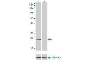 Western blot analysis of NME1 over-expressed 293 cell line, cotransfected with NME1 Validated Chimera RNAi (Lane 2) or non-transfected control (Lane 1).